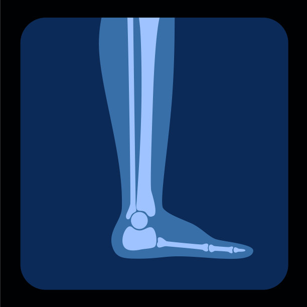 骨骼x射线图片下载