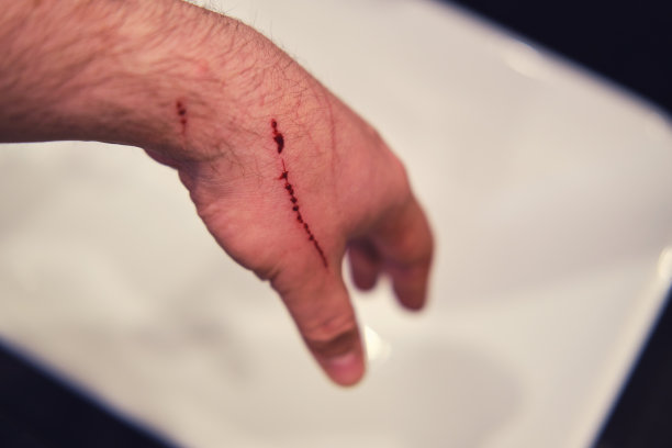 手在浴室水槽上被猫抓伤，有血的特写图片下载