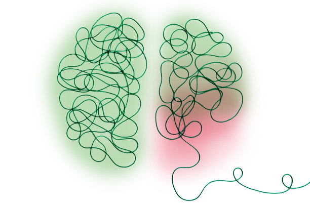 用线和颜色描绘人脑，作为神经系统疾病的象征图片下载