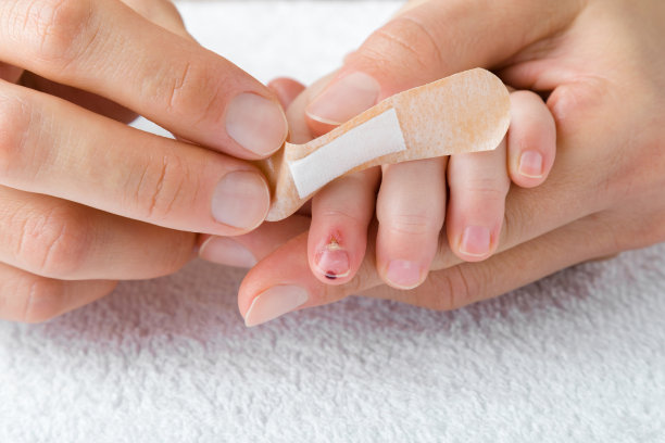 年轻的成年妇女手牵着婴儿的手，用白色毛巾在划伤的手指和打过的指甲上粘贴绷带。母亲正在进行急救。特写镜头。前视图。图片下载