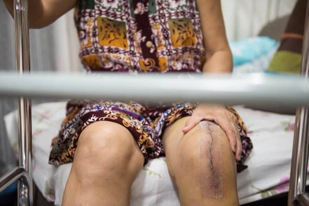 恢复膝盖手术妇女与行走架图片下载