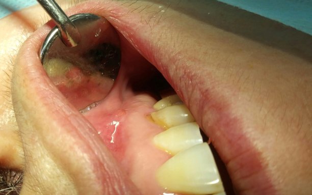 口腔门诊VH544口腔检查图片下载