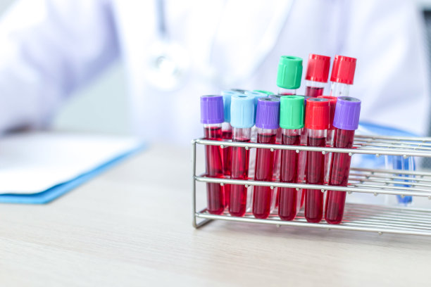 血管照片实验室科学试管。图片下载