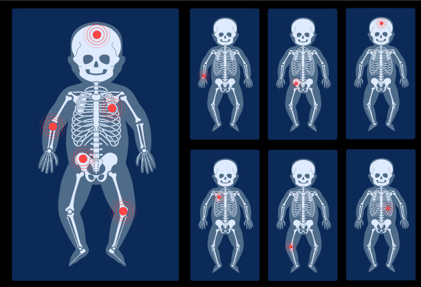 骨骼x射线图片下载