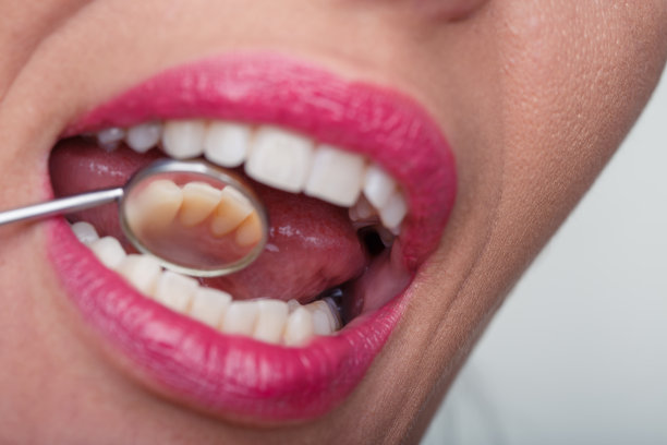 为了持久的微笑去看牙医图片下载