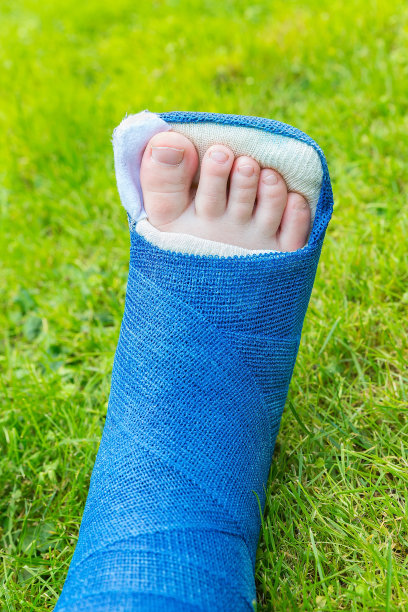 一只蓝色的石膏脚踩在绿色的草地上图片下载