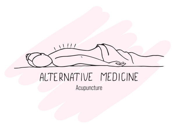 这个女孩正在接受针灸治疗。替代医学图片下载