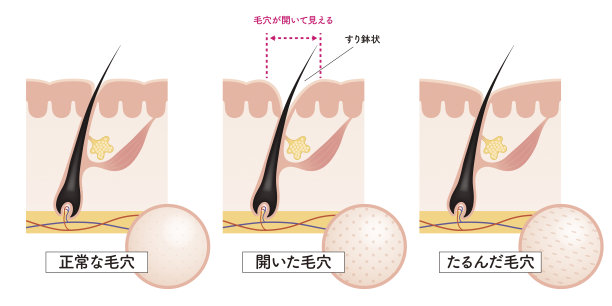 皮肤正面的横切面图片下载