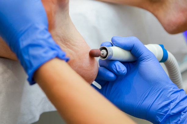 一个女人在她的脚上工作的特殊工具的特写。修脚。老茧的锉削。图片下载