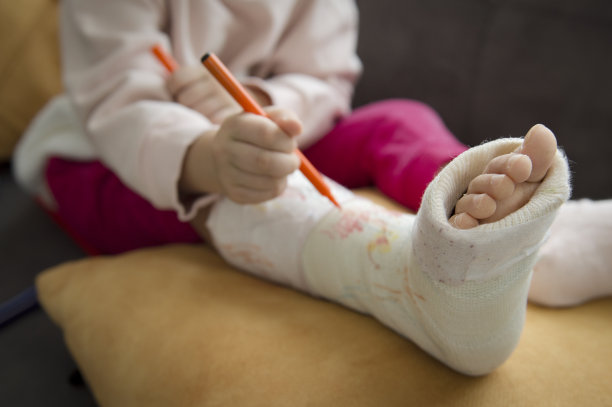 断腿打上石膏图片下载