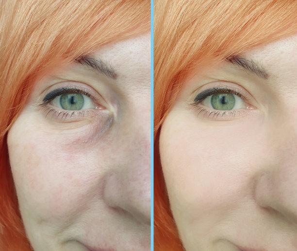 女人脸部皱纹治疗前后拼贴图片下载