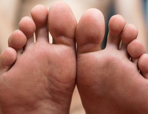 脚部疼痛的人。理疗师的概念。近距离图片下载