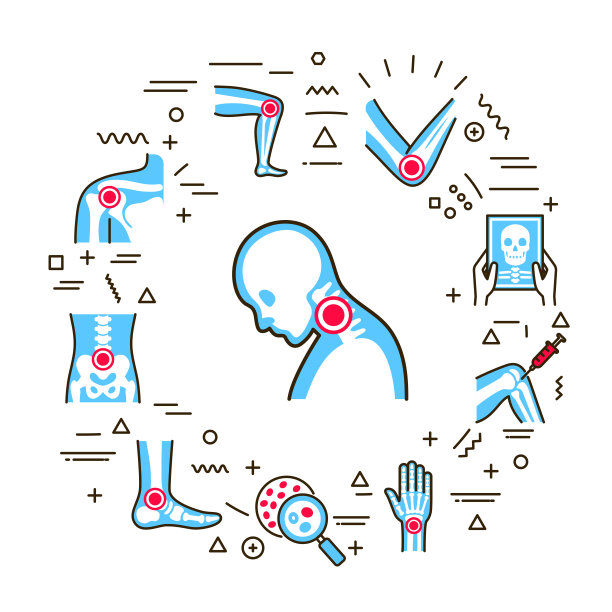 关节炎疾病网页横幅。信息图与线性图标在白色的背景。创意概念。孤立轮廓彩色插图图片下载