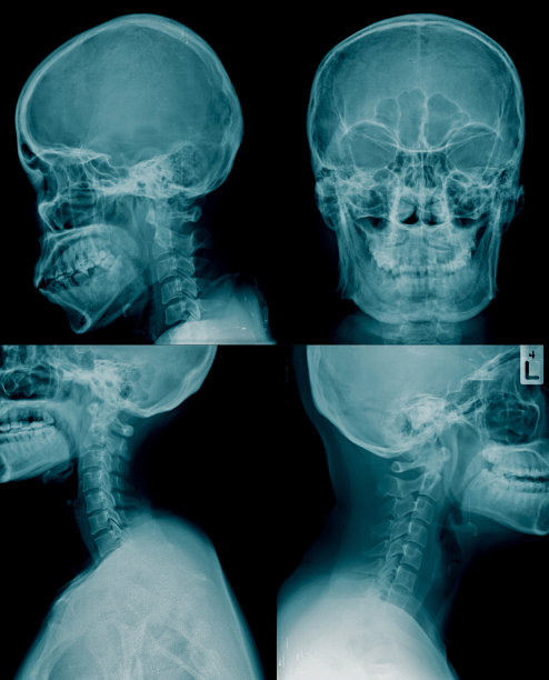 采集颅骨x射线图像，蓝色图片下载