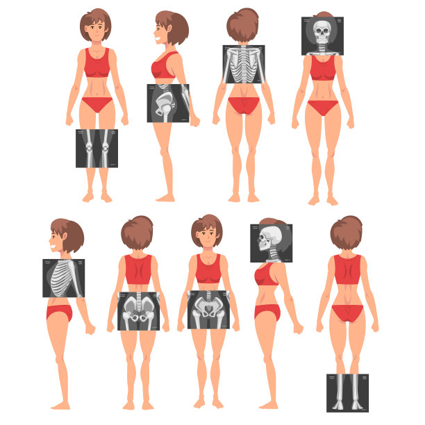 x光检查确定该年轻女子为图片下载