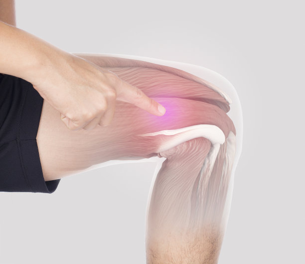 大腿肌肉发炎感到疼痛图片下载