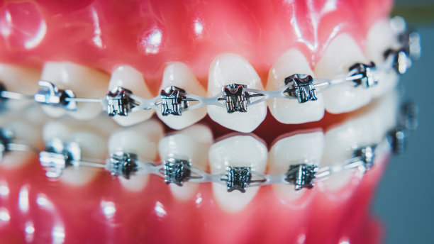 在微距照片上显示了括号系统是如何安排的图片下载