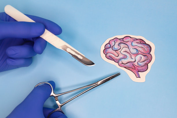 人脑的紧急手术铅笔绘图。图片下载