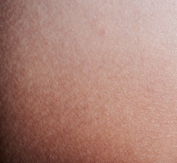 粉色的皮肤图片下载