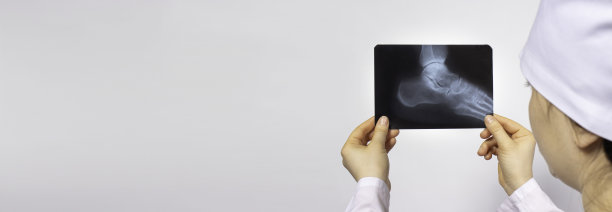 医生或放射科医生拿着一张人脚的x光片。腿部受伤，脚后跟开裂或骨折。带有文本位置的横幅图片下载