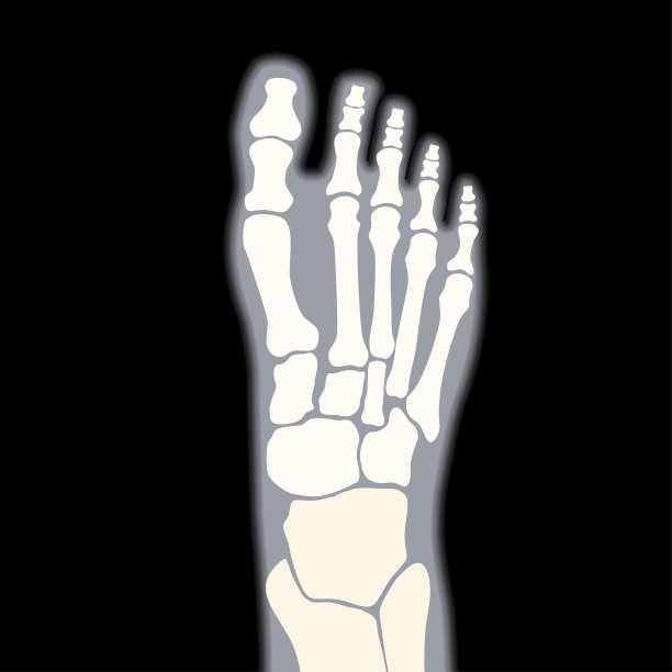 正常的骨头图片下载