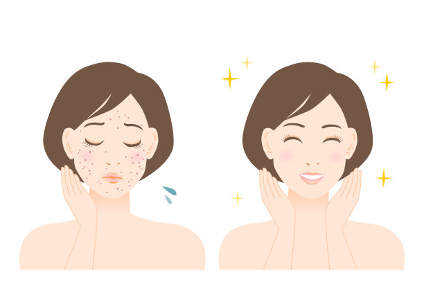 女人的美丽插图。痘痘、斑点和雀斑的烦恼。白色背景。矢量插图。图片下载