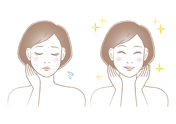 女人的美丽插图。痘痘、斑点和雀斑的烦恼。白色背景。矢量插图。图片下载