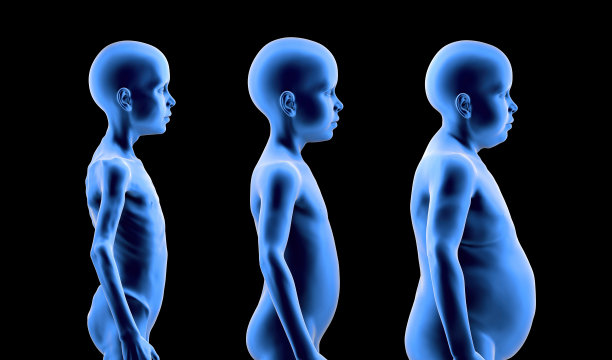 营养不良儿童，与正常体型和肥胖儿童相比图片下载