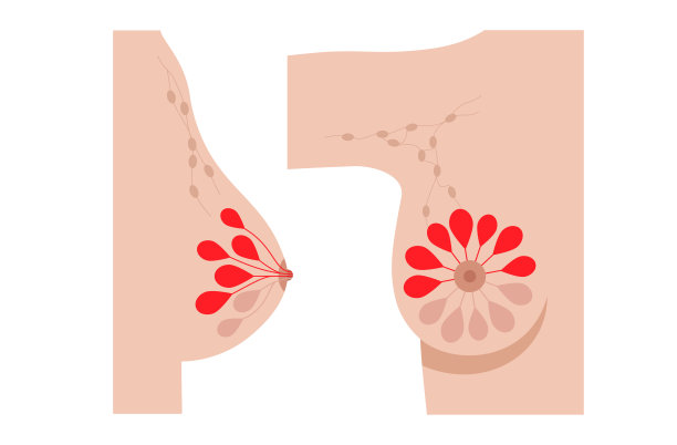 乳腺疾病的概念图片下载