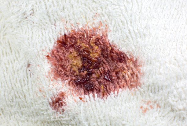 白色棉布毛巾或地毯上有脏的食物污渍。近距离的照片。图片下载