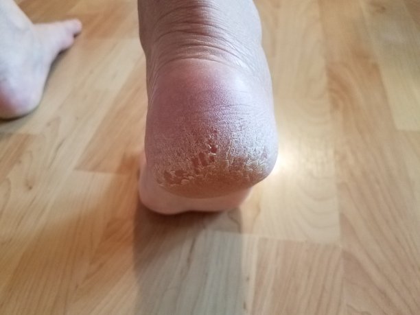 又干又硬的女人脚后跟踩在木地板上图片下载