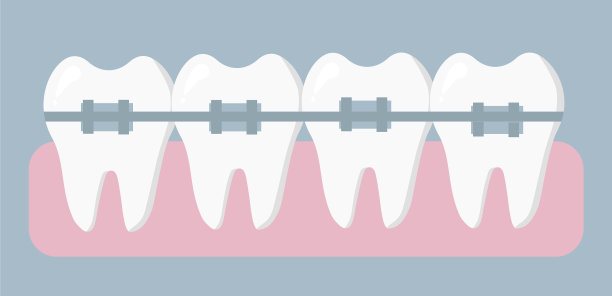 矫正牙齿的牙套图片下载