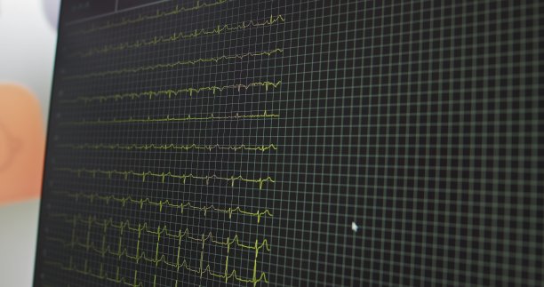 医院剧院的心率监测器。医用生命体征监护仪是在医院进行麻醉手术监护时使用的。心电图。病人在屏幕前的心跳。真正的指标。心电图或心电图检查图片下载