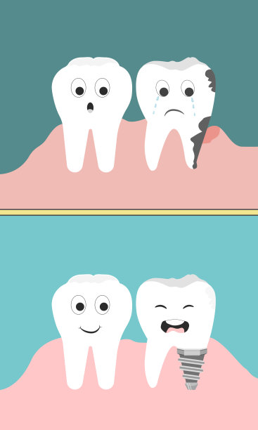 牙齿快乐和牙齿悲伤。牙科种植体结构医学图片教育图形海报。牙线和牙线卡通风格的概念。向量,插图。图片下载