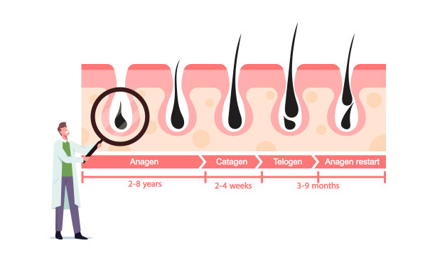 微型医生字符与巨大的放大镜在医学信息图代表头发生长和脱落周期图片下载