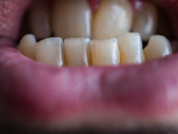 男人的嘴合上露出牙齿。牙医的概念图片下载