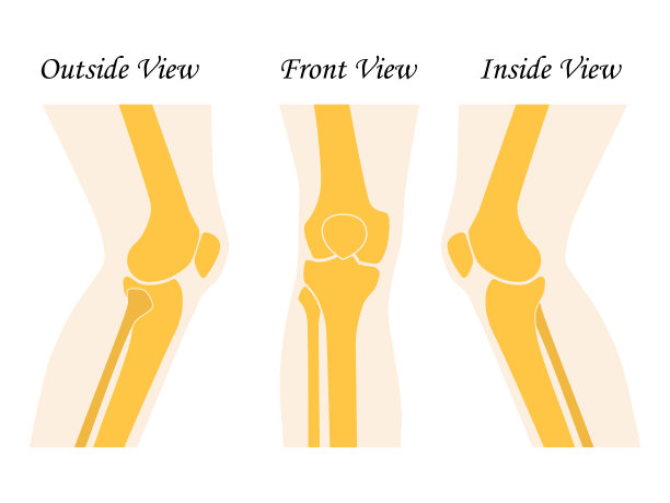 人膝盖腿前后视图。矢量插图。平面设计图片下载