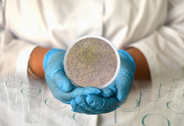 一个穿着病袍、戴着手套的女孩拿着一张圆形镜框里显微镜下的白色念珠菌照片图片下载