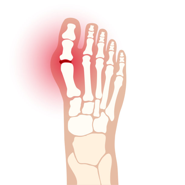 关节炎脚概念图片下载