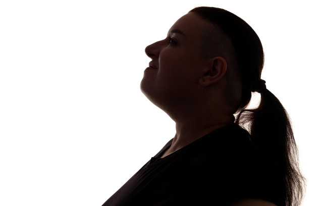 吸下巴抽脂塑造面部轮廓的超重女性图片下载