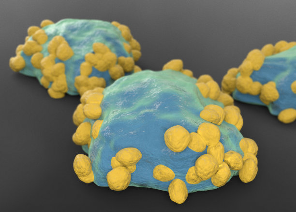 淋巴瘤癌细胞图片下载