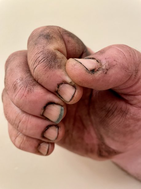 男人的脏手和指甲。图片下载
