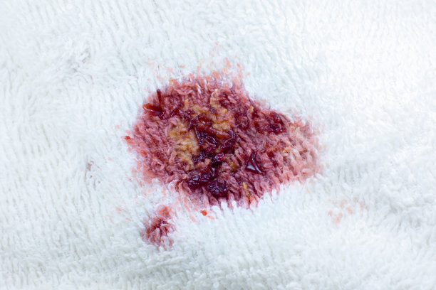 白色棉布毛巾或地毯上有脏的食物污渍。近距离的照片。图片下载