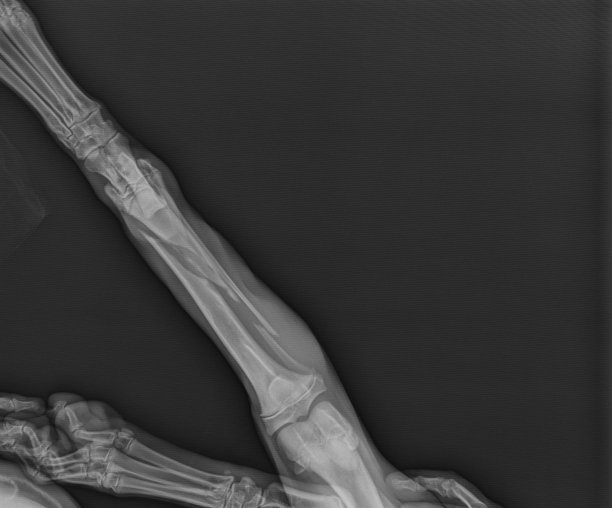 狗X线显示斜胫骨骨折头颅视图图片下载