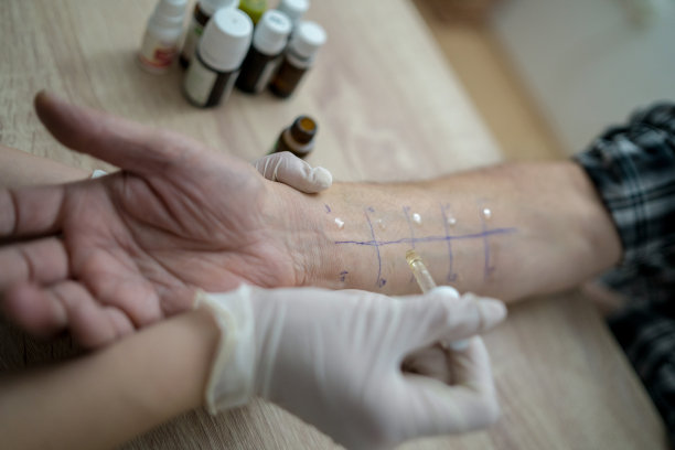 皮肤点刺过敏试验图片下载