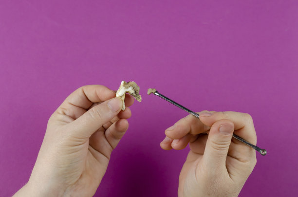 大动物牙齿，女性的手和牙齿刮刀洋红b图片下载