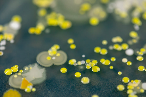 霉菌美丽，菌落特性的培养培养基板从实验室微生物。图片下载