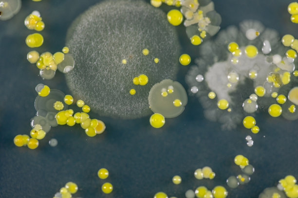 霉菌美丽，菌落特性的培养培养基板从实验室微生物。图片下载