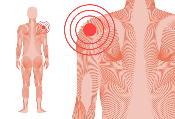 肩痛的概念图片下载