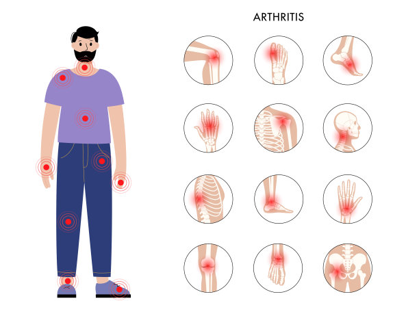 男人剪影中的关节炎图片下载